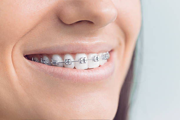 Best Dental Exams and Cleanings  in Red Chute, LA